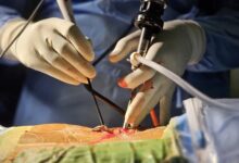 Best Endoscopic Spine Surgeon in Kerala