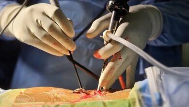 Best Endoscopic Spine Surgeon in Kerala