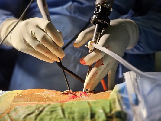 Best Endoscopic Spine Surgeon in Kerala