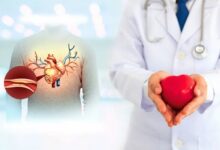 Best Heart Doctor in Guwahati