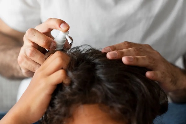 GFC Hair Treatment​ in Kolkata