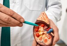 Ayurvedic Doctor in India