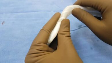 Semi-Rigid Penile Implant Surgery in India