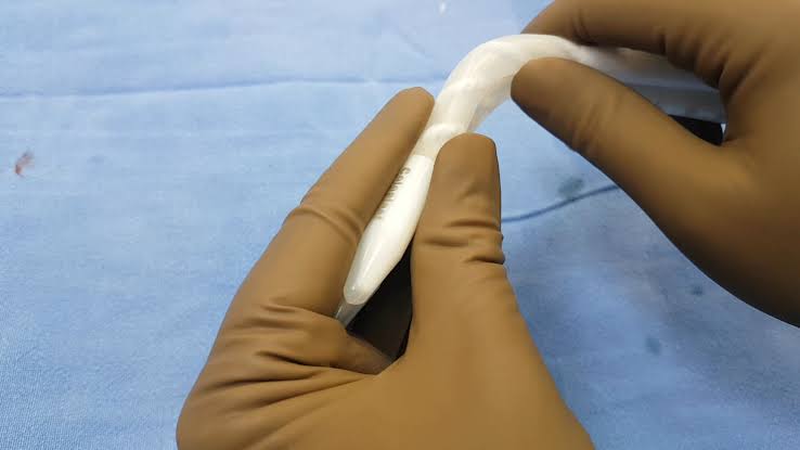 Semi-Rigid Penile Implant Surgery in India