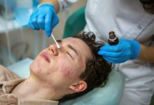 Acne Treatment in Mumbai
