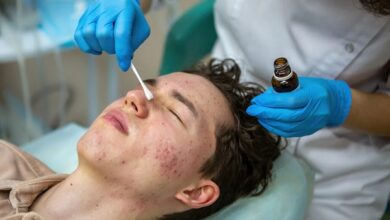 Acne Treatment in Mumbai