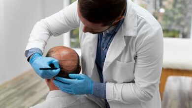 Best FUE clinic in Chicago